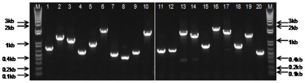 一種棘阿米巴特異性抗原肽、多克隆抗體及其用途